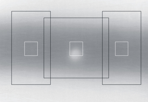 Camera-assisted Vision System